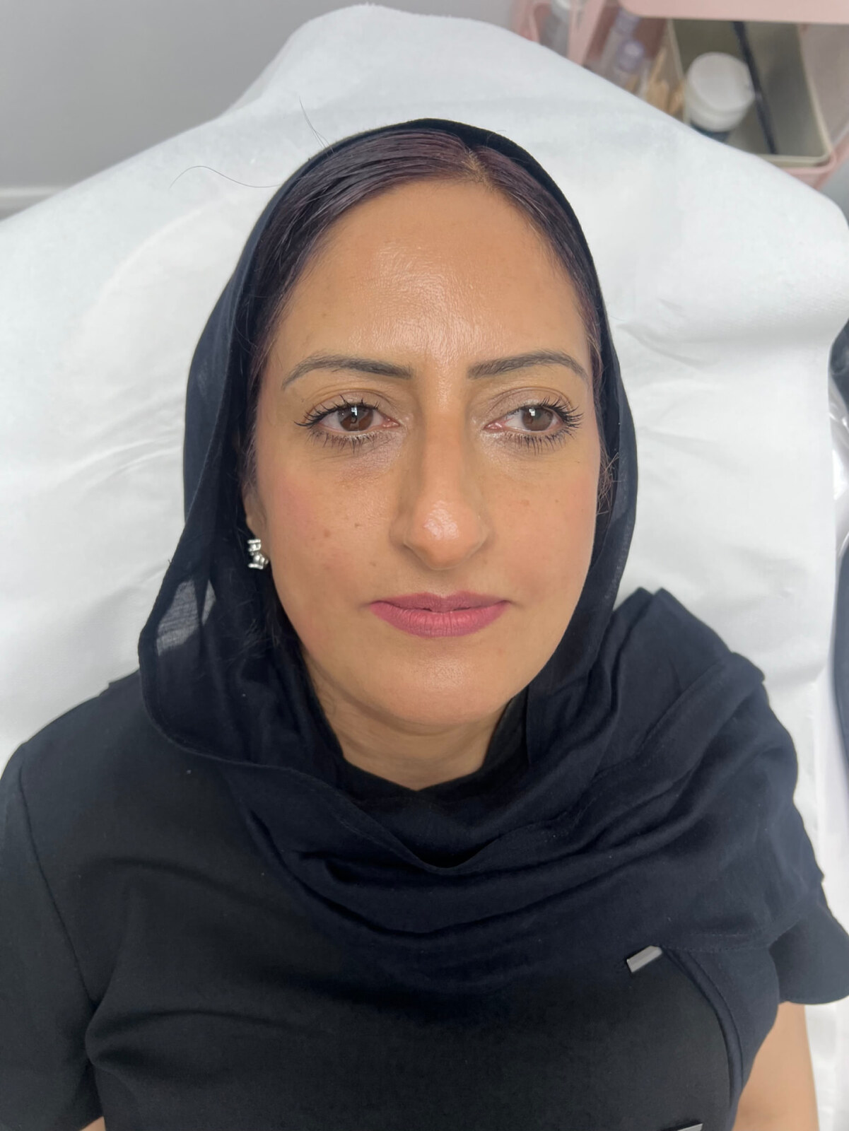 Dermal filler